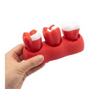 YRQMGSF Modello Dimostrativo di Intarsio Dentale - Modello di Lesioni Cariose per Restauro Dentale - Modello Didattico di Educazione Orale