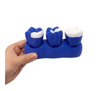 YRQMGSF Modello Dimostrativo di Intarsio Dentale - Modello di Lesioni Cariose per Restauro Dentale - Modello Didattico di Educazione Orale