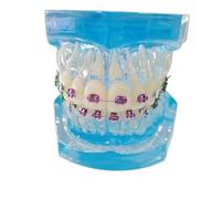 YRQMGSF Modello Ortodontico Dentale, Modelli Dentali con Apparecchi Metallici Trasparenti, per Insegnare la Comunicazione Medico-Paziente