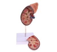 YUEHISY Modello di Anatomia del Rene Umano con 24 Marcatori per | 24 marcatori sulle strutture del profilo renale, Due componenti con zonatura codificata a colori chiari, Materiale in PVC,