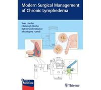 Yves Harder Modern Surgical Management of Chronic Lymphede (Mixed Media Product)