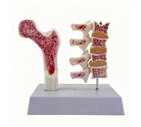 YXHXWKJ Modello di anatomia umana-osteoporosi, modello anatomico di scheletro delle vertebre con scheda di studio for dimostrazione didattica for studenti di medicina