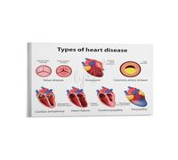 YZWRWRMKTB Heart Disease Education Poster Symptoms Risk Factors and Prevention Guide Chart for Clinic Hospital Health Fair Wall-Art Decor(Unframed,08x12inch(20x30cm))