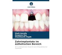 Zahnimplantate im ästhetischen Bereich: Ein multidisziplinärer Ansatz für den Erfolg ästhetischer Implantate