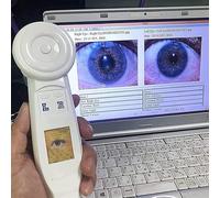 ZHIXUMM Telecamera per Iridologia, Telecamera per L'Analisi Dell'Iride con Lente Dell'Iride da 1,3 Milioni di Pixel, Rilevatore Dell'Iride, con Software Professionale, con Messa A Fuoco Regolabile