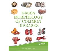 Zu-Hua Gao, MD PhD Frcpc Gross Morphology of Common Diseases (Copertina rigida)