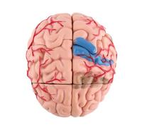 Zunate Modello di Anatomia del Cervello Umano in Plastica |Smontato per il Montaggio, Colorato Altamente Simulato, Strumento di Studio Neurologico, Insegnamento Medico, Display Clinico, Educazione del