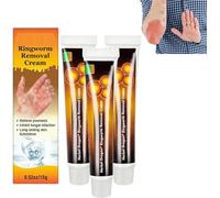 zzqclp Crema per la psoriasi,Unguento lenitivo per la psoriasi,Crema per la rimozione della tigna del Drago alle Erbe,Crema lenitiva e idratante per la psoriasi