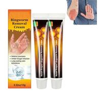 zzqclp Crema per la psoriasi,Unguento lenitivo per la psoriasi,Crema per la rimozione della tigna del Drago alle Erbe,Crema lenitiva e idratante per la psoriasi